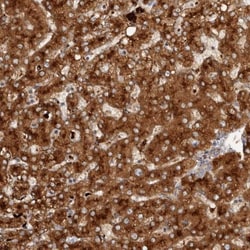 AGL Antibody, Novus Biologicals 0.1mL; Unlabeled:Antibodies, Polyclonal